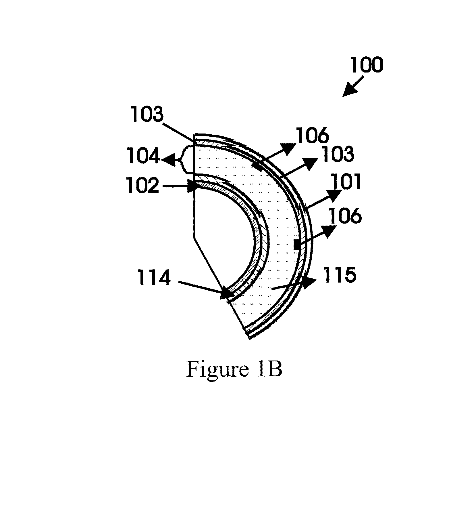 Mode tailored spherical laser