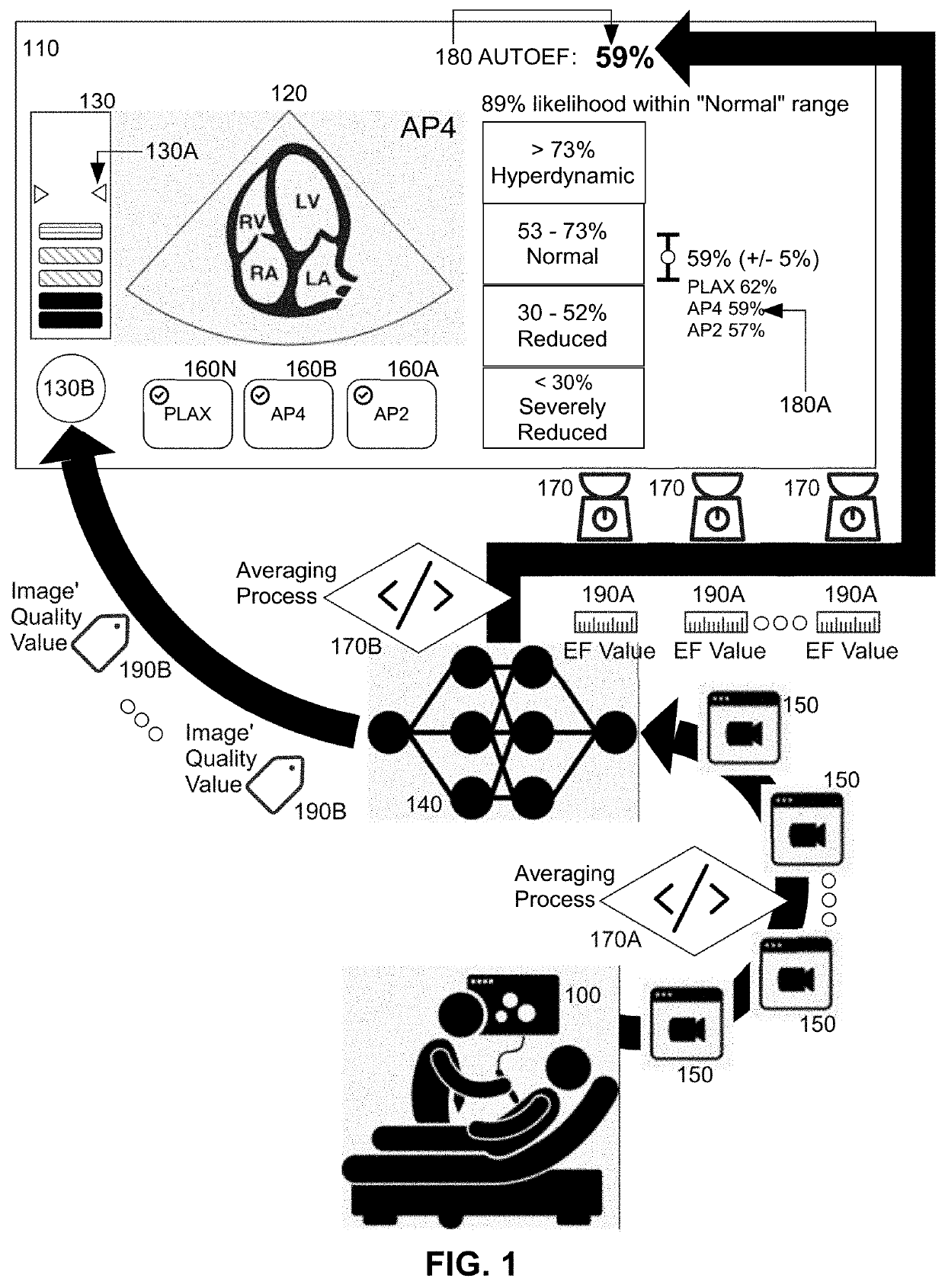 Continuous and dynamic ejection fraction determination