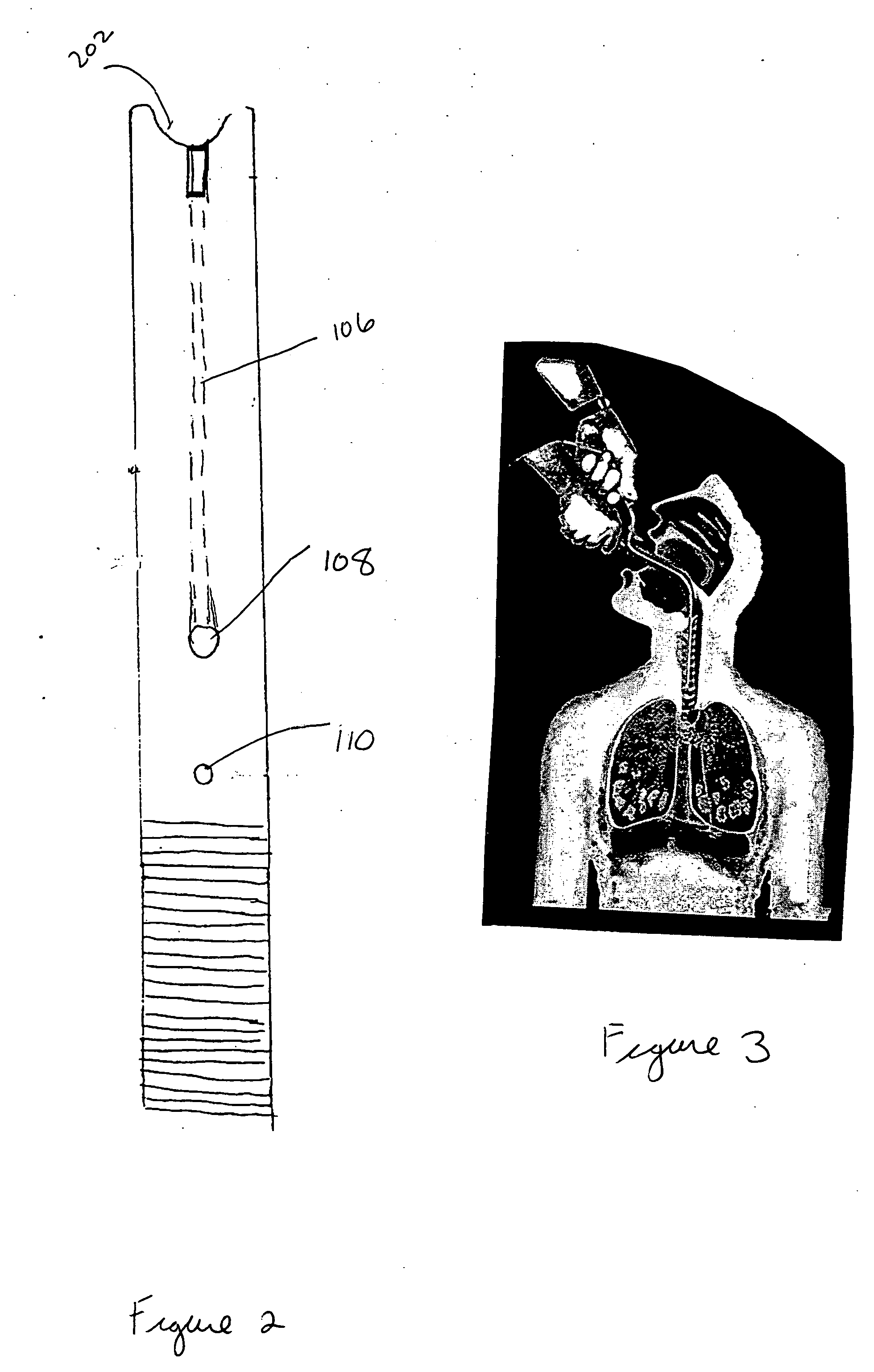 Insertion aid for oral and nasal medical devices