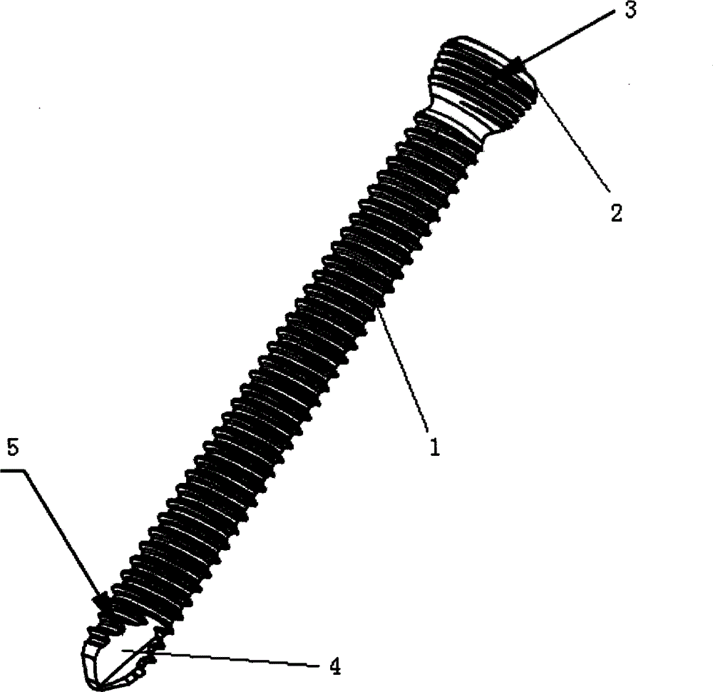 Bone joining plate locking screw