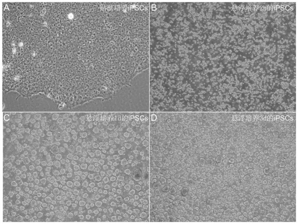 Culture method for preparing pancreatic beta cells by inducing directional differentiation of pluripotent stem cells