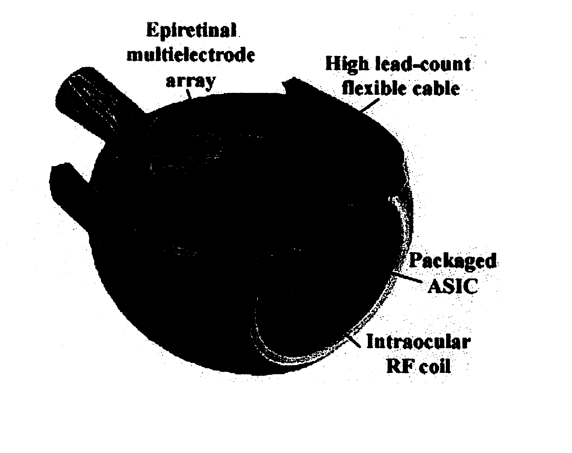 Batch-fabricated flexible intraocular retinal prosthesis system and method for manufacturing the same