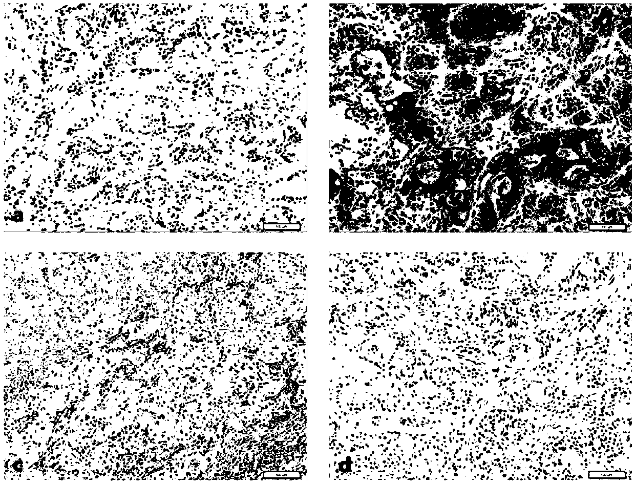 Immune cell containing tumor antigen recognition receptor and application of immune cell