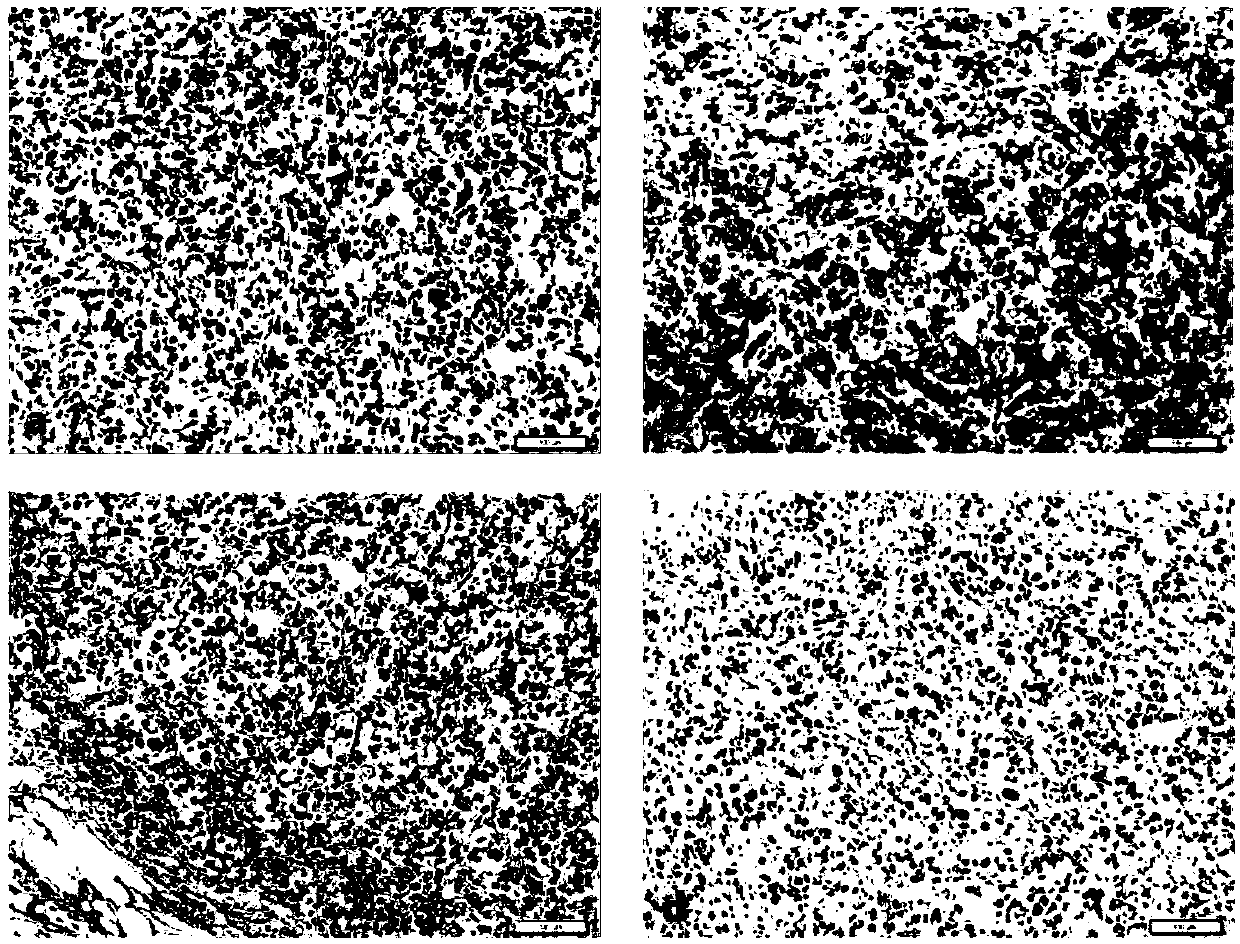 Immune cell containing tumor antigen recognition receptor and application of immune cell