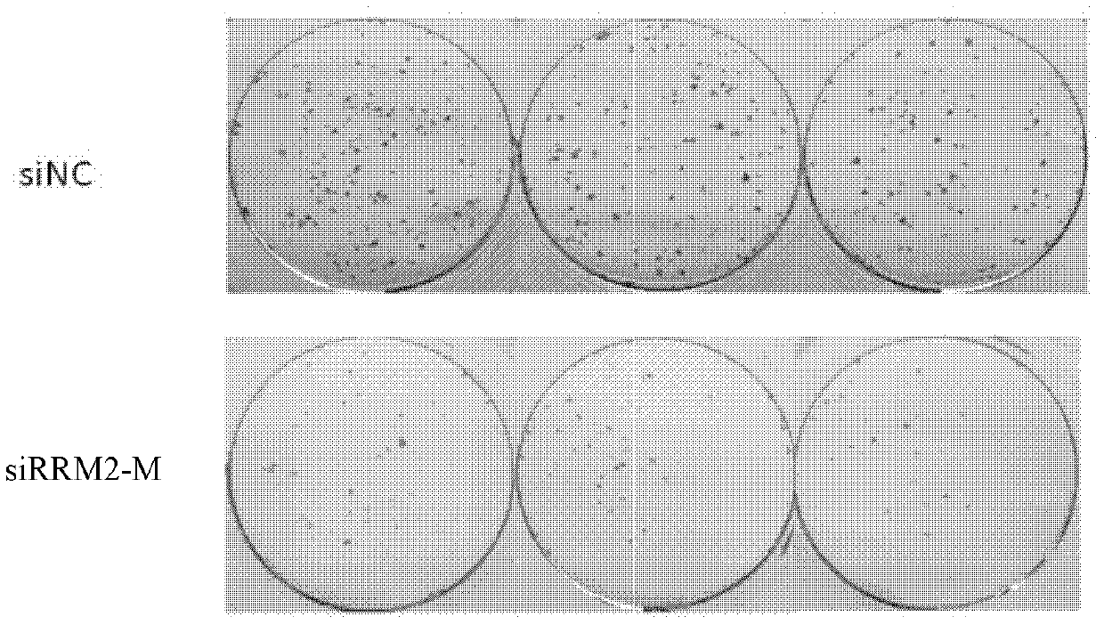 A kind of small interfering nucleic acid and pharmaceutical composition and application thereof