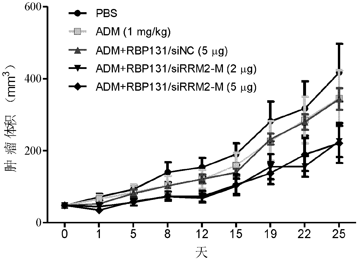 A kind of small interfering nucleic acid and pharmaceutical composition and application thereof