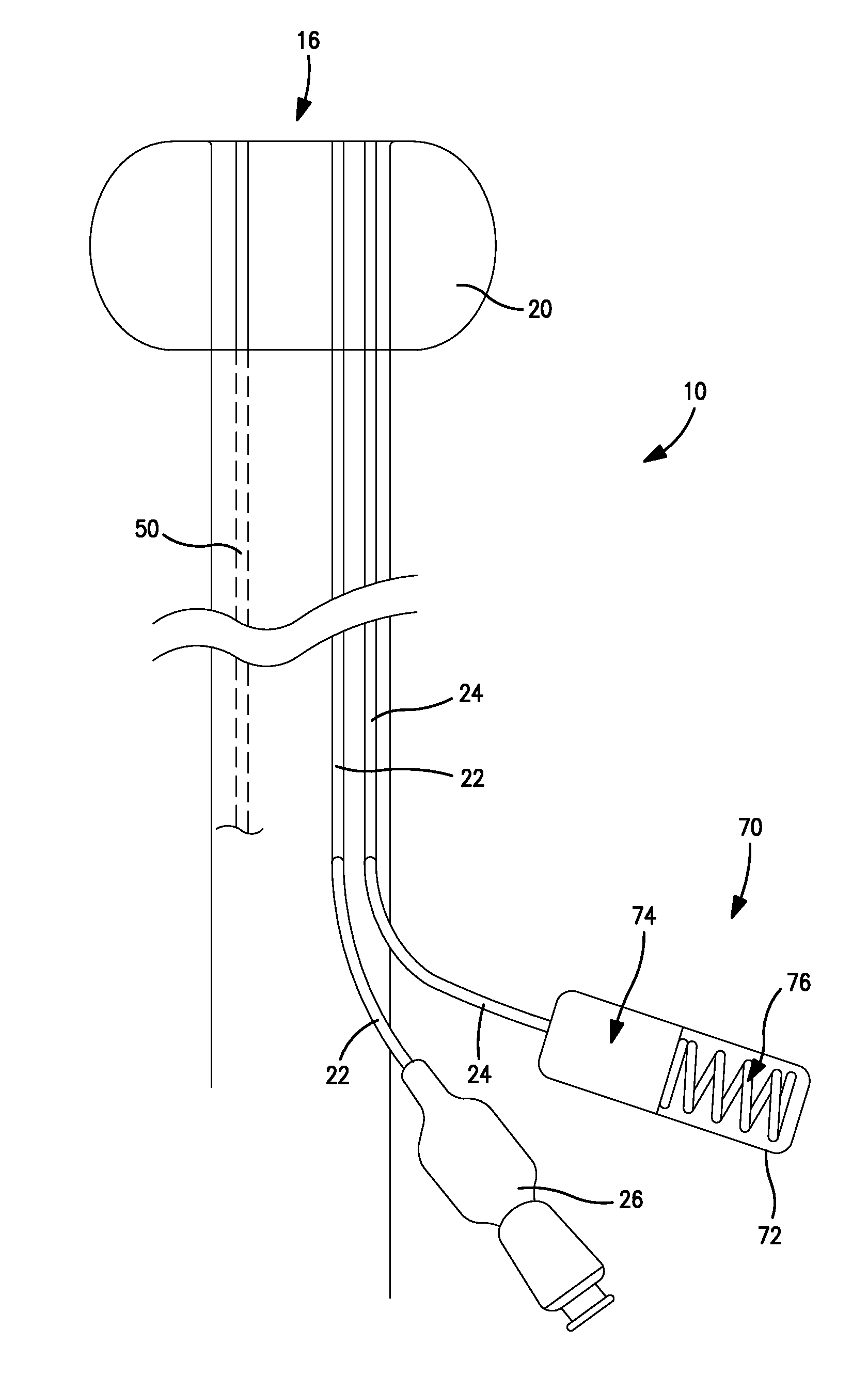 Rectal drain appliance