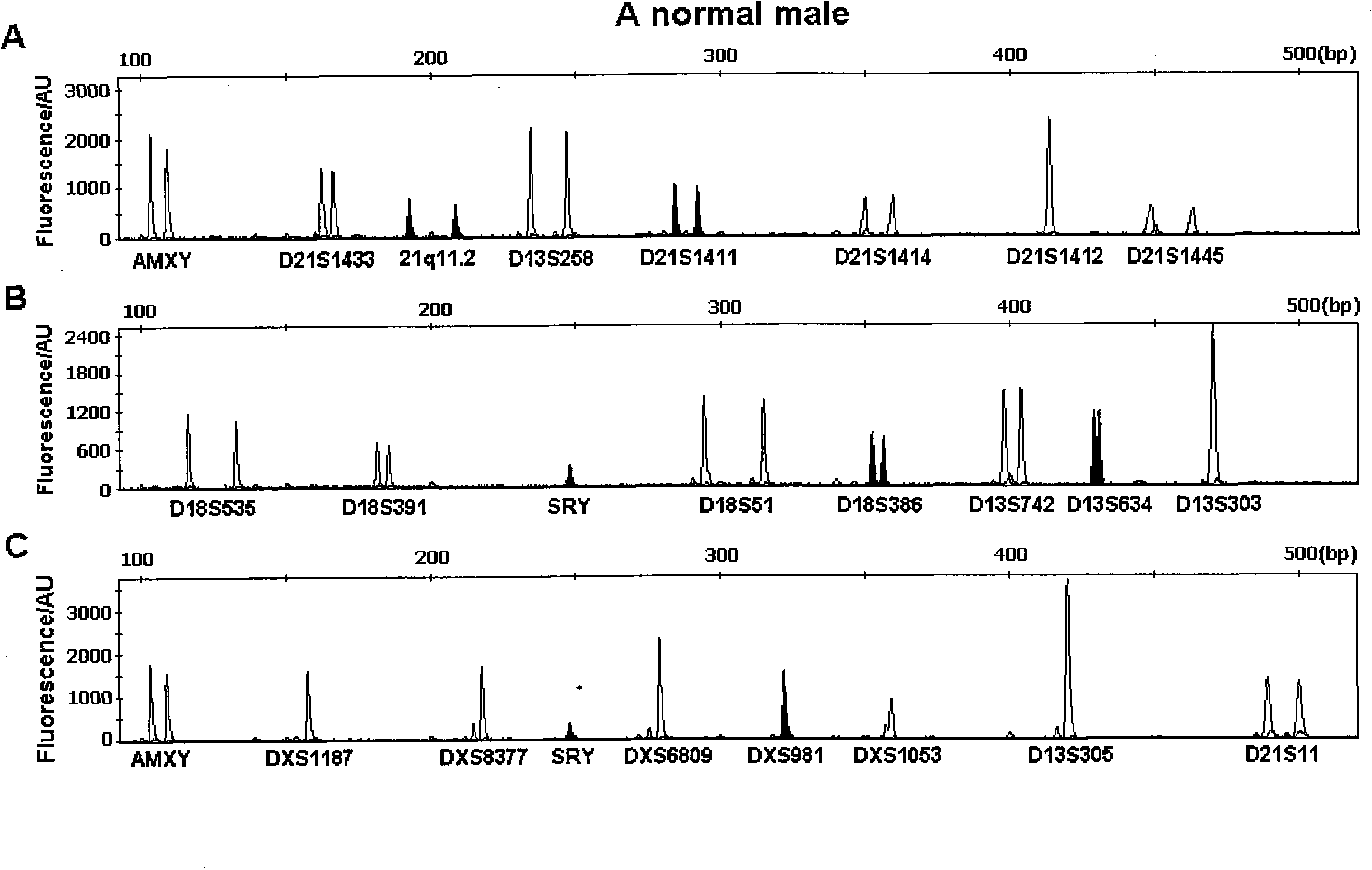 Multi-QF-PCR STR detection system for performing fast diagnosis on numerical abnormality of chromosomes