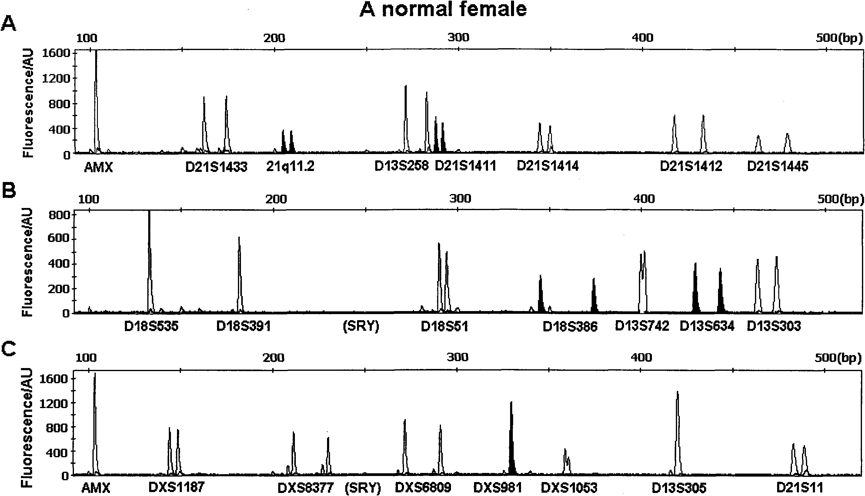 Multi-QF-PCR STR detection system for performing fast diagnosis on numerical abnormality of chromosomes