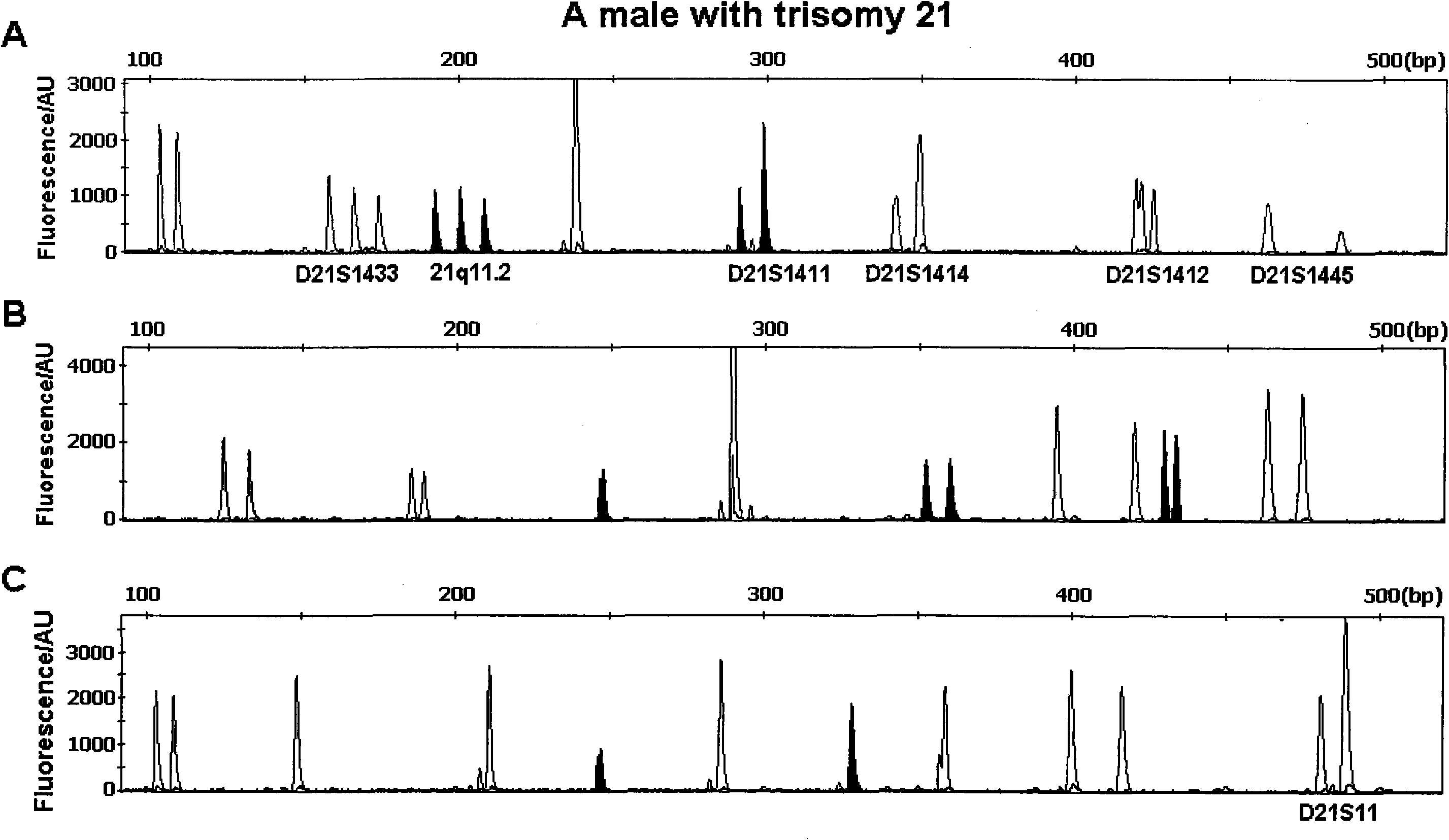 Multi-QF-PCR STR detection system for performing fast diagnosis on numerical abnormality of chromosomes