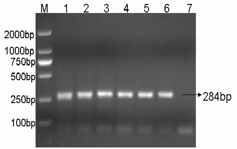 Liquid-phase chip method used for detecting infectious laryngotracheitis virus