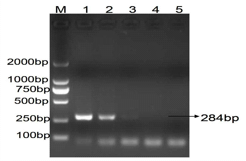 Liquid-phase chip method used for detecting infectious laryngotracheitis virus