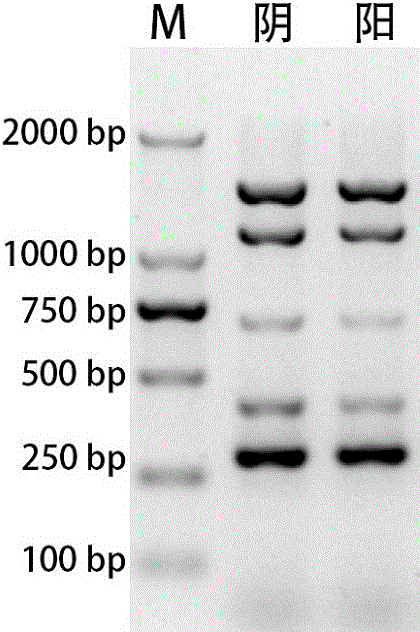 Kit for simultaneously detecting Vibrio parahaemolyticus, Escherichia coli O157:H7, Salmonella and Shigella