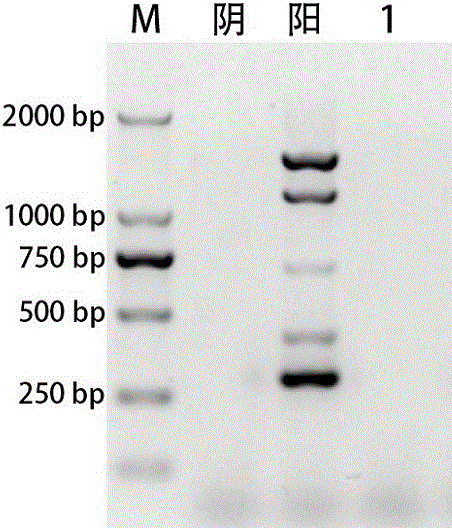 Kit for simultaneously detecting Vibrio parahaemolyticus, Escherichia coli O157:H7, Salmonella and Shigella