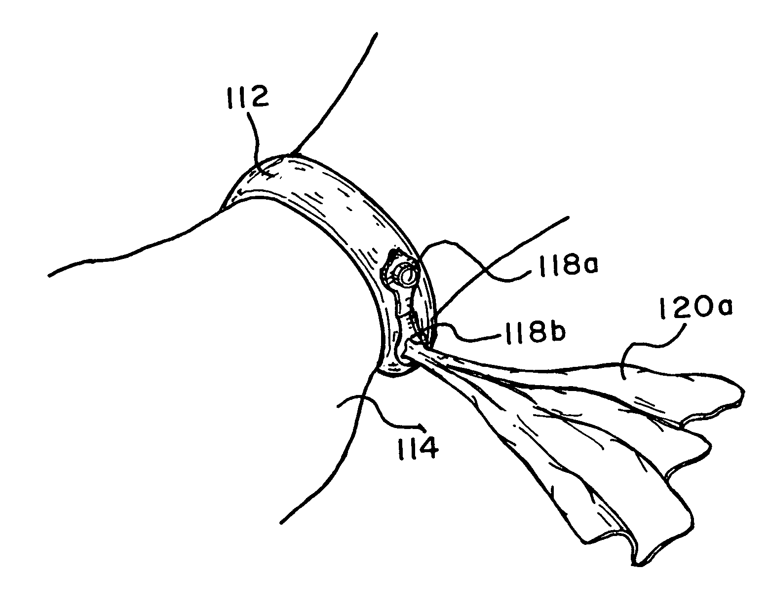 Wrist-worn wipes dispenser