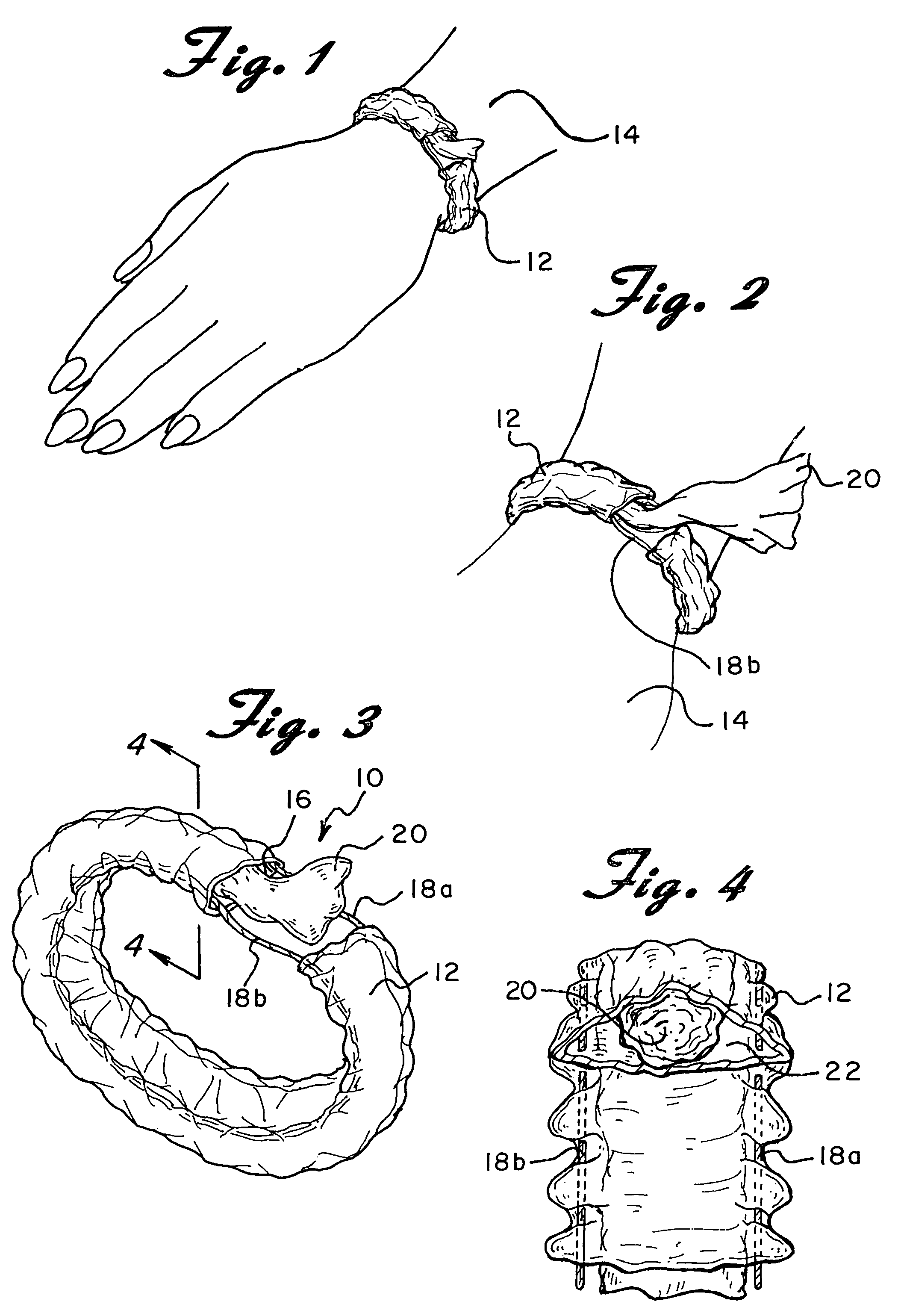 Wrist-worn wipes dispenser