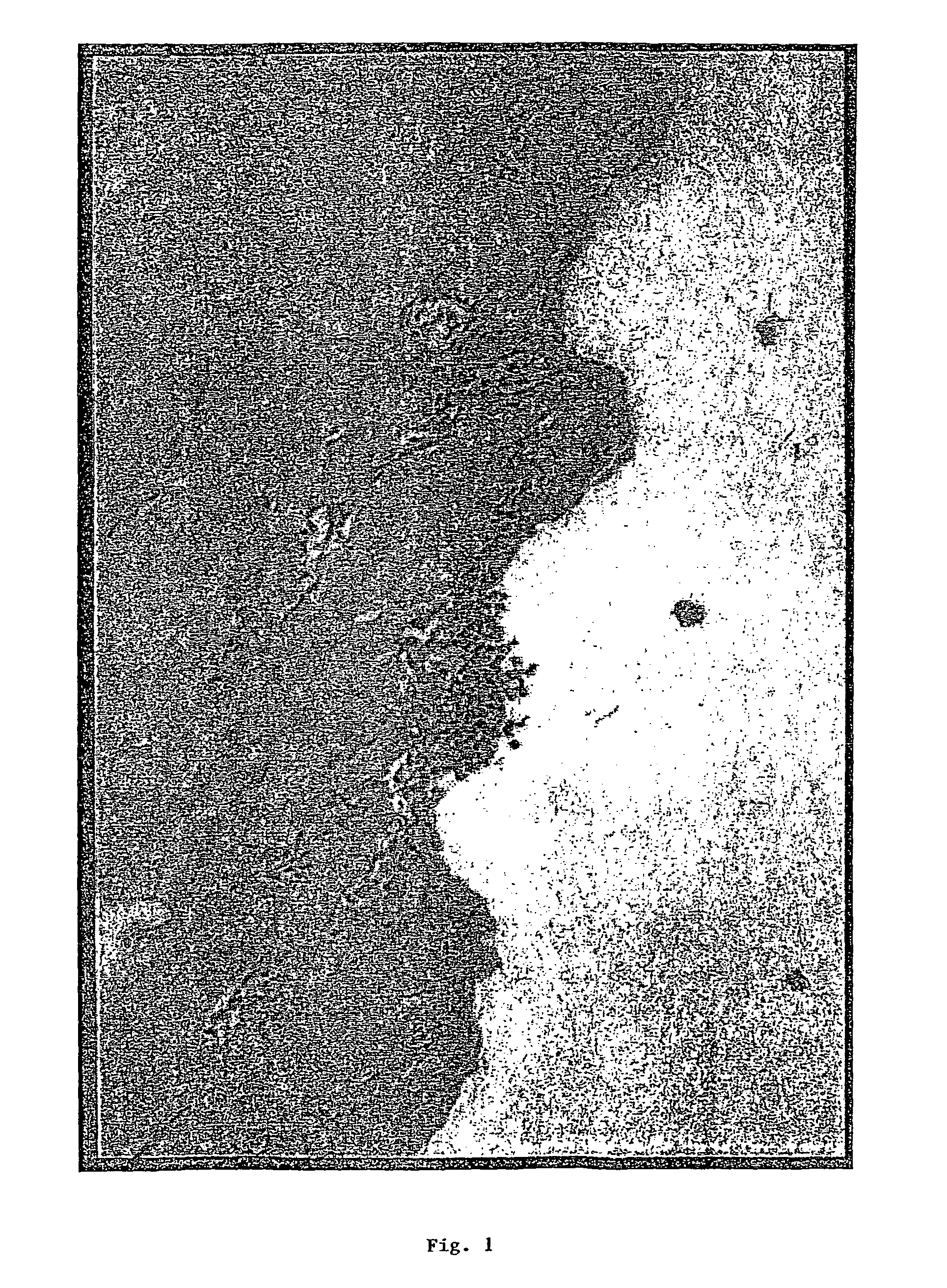 Method for the reduction or prevention of post-surgical adhesion formation