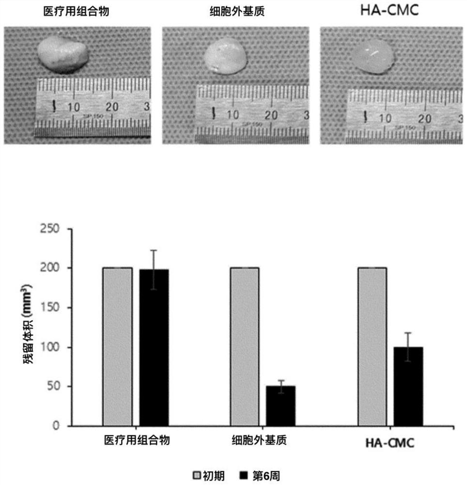 Medical composition comprising adipose tissue-derived extracellular matrix and method for producing same