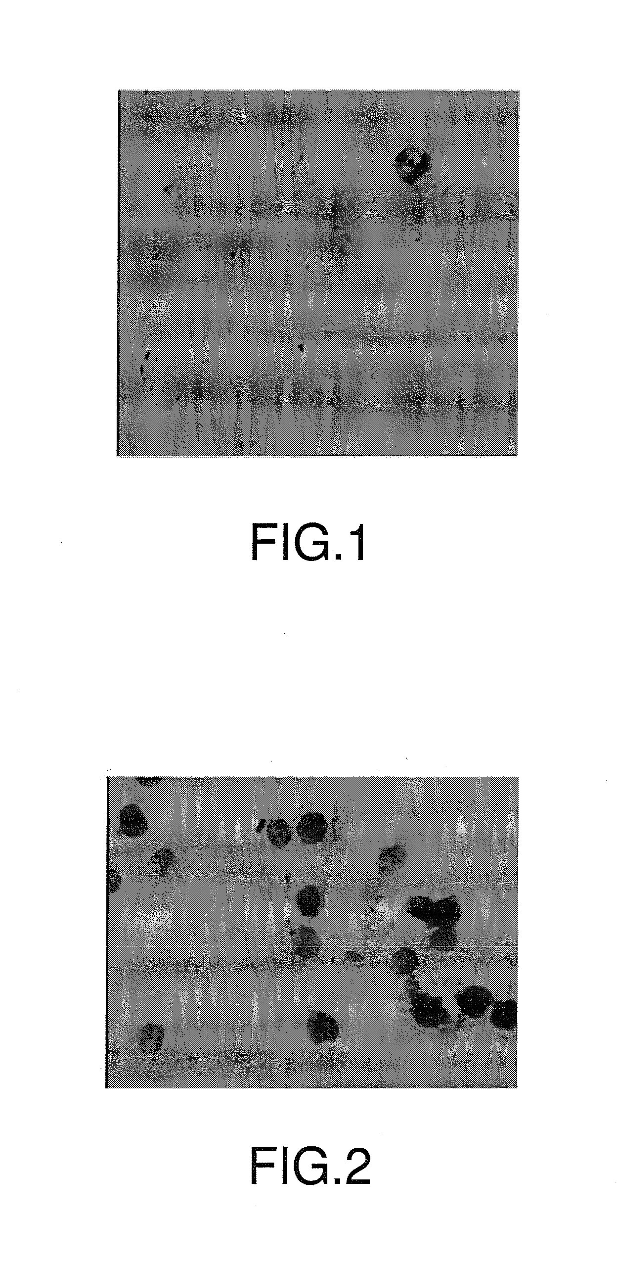 Assay kit for in-situ hybridization of rhogdi2 gene, method therefor and use thereof the assay kit