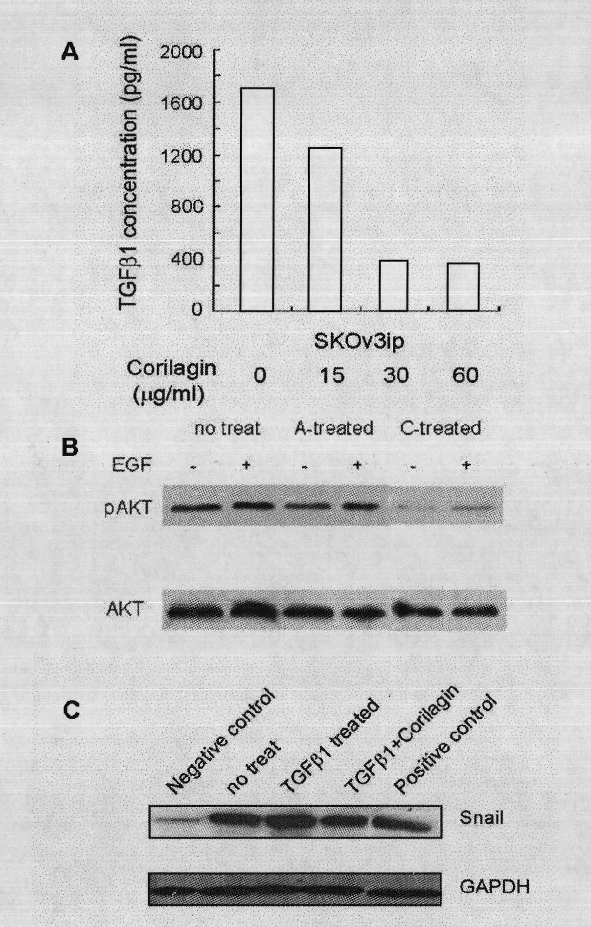 Application of Corilagin in preparing anti-tumor drugs