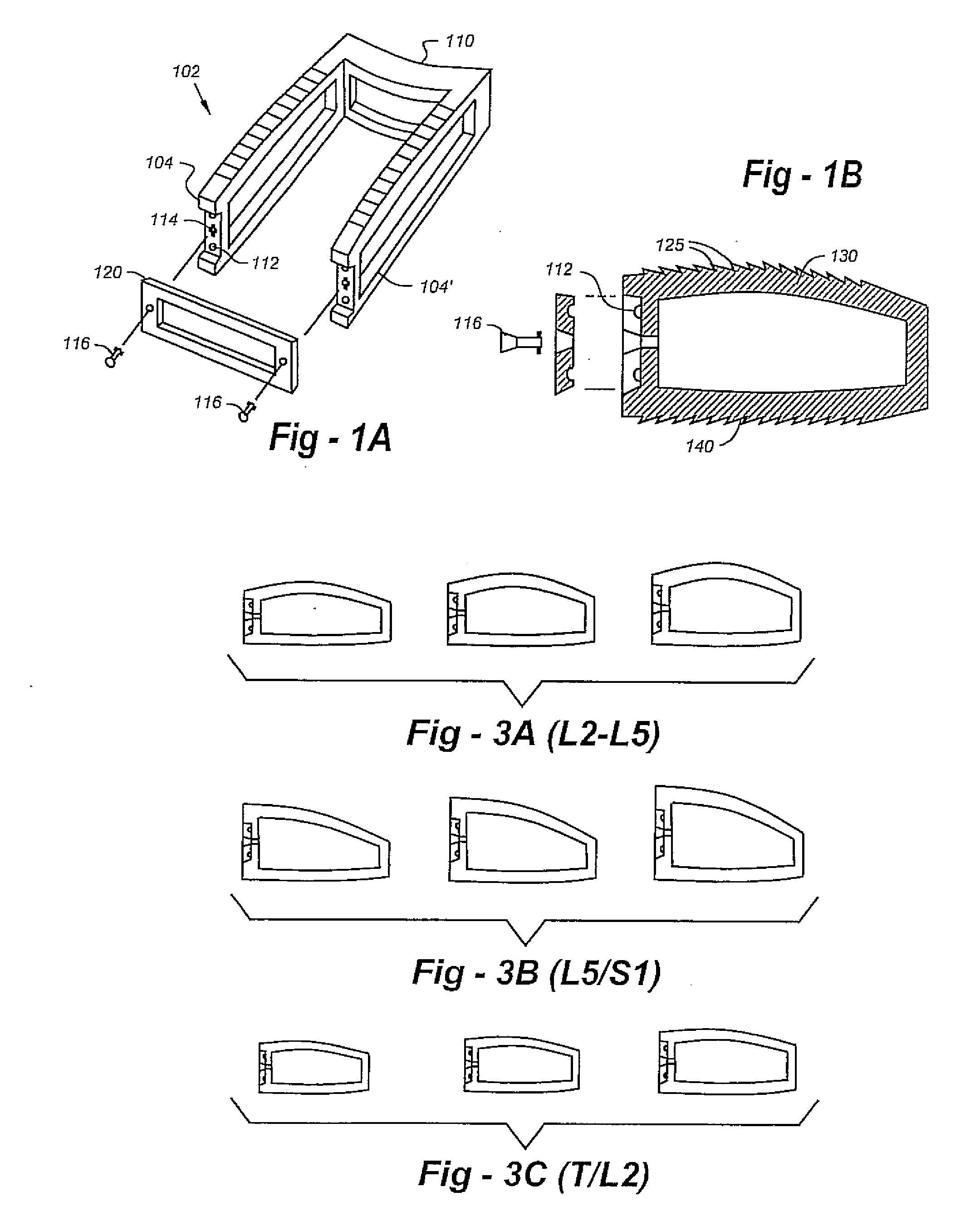 Intervertebral cage designs