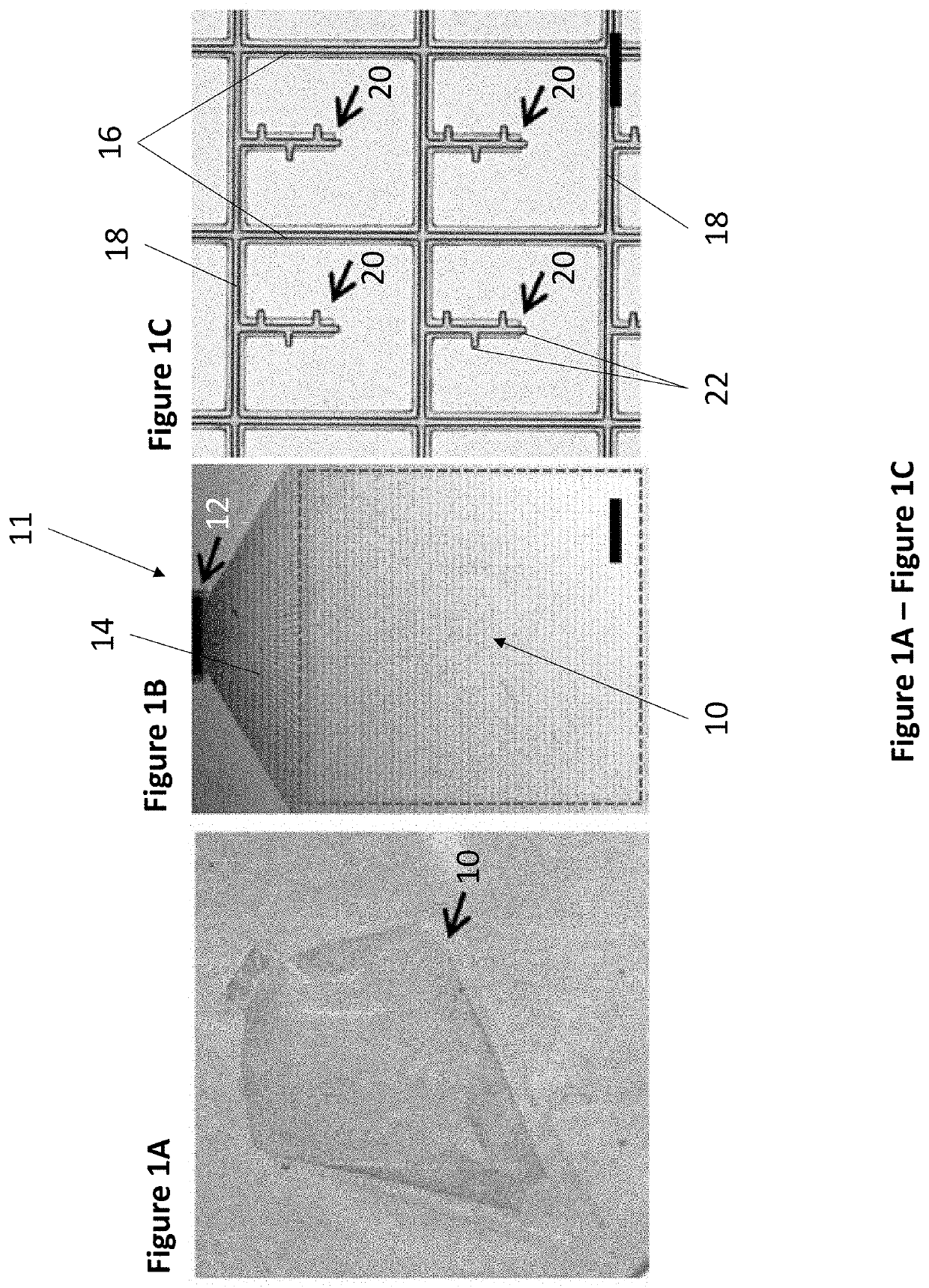 A novel flexible microfluidic meshwork for glaucoma surgery