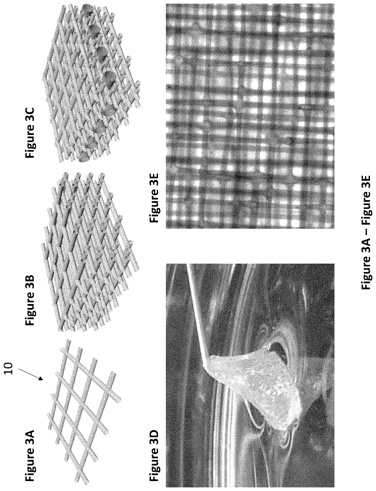 A novel flexible microfluidic meshwork for glaucoma surgery