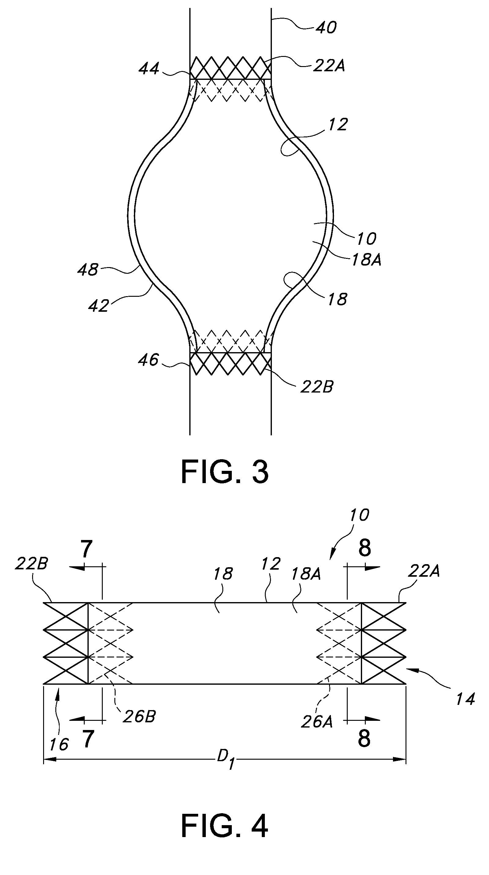 Sac liner for aneurysm repair