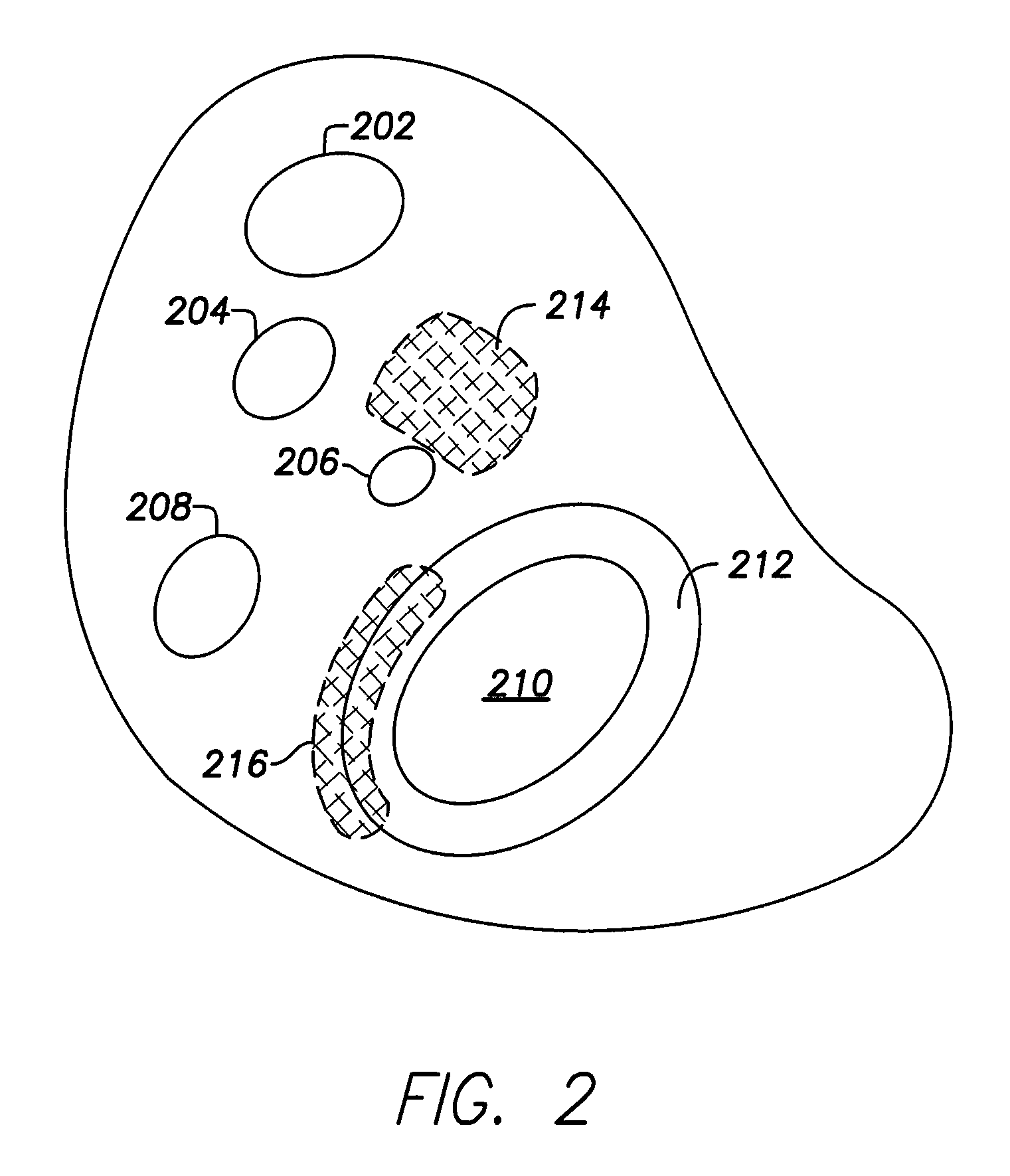 Single chamber leadless intra-cardiac medical device with dual-chamber functionality