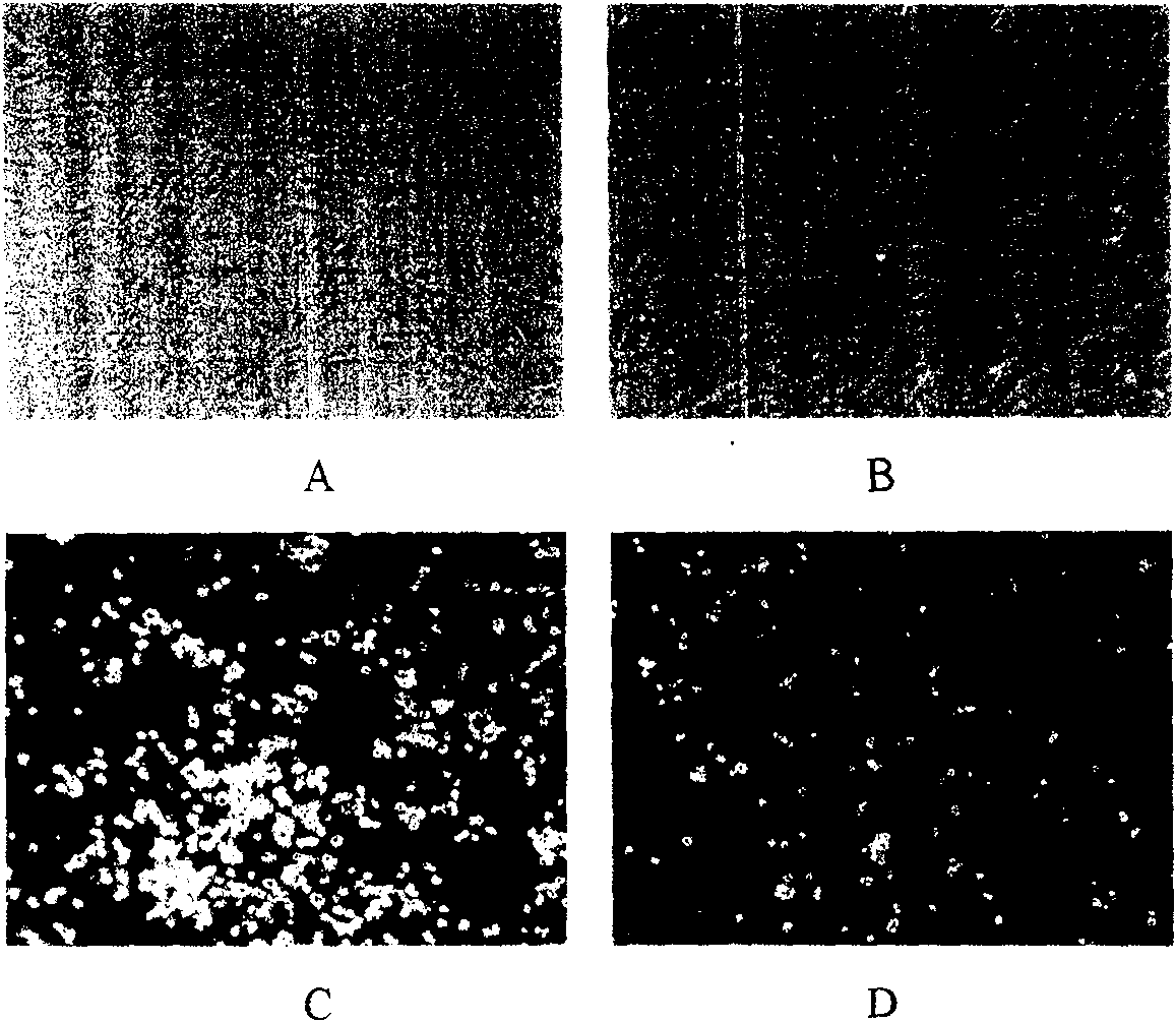 Method for sorting primary human marrow mesenchy malstem cell by monoclonal antibody ZUB4 immunomagnetic bead