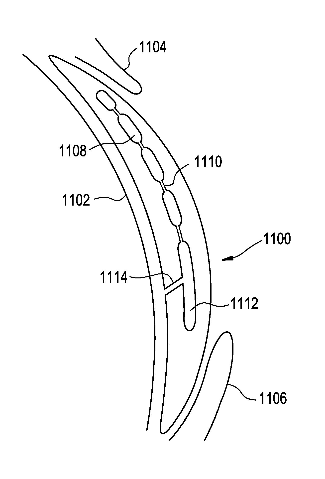 Dynamic fluid zones in contact lenses