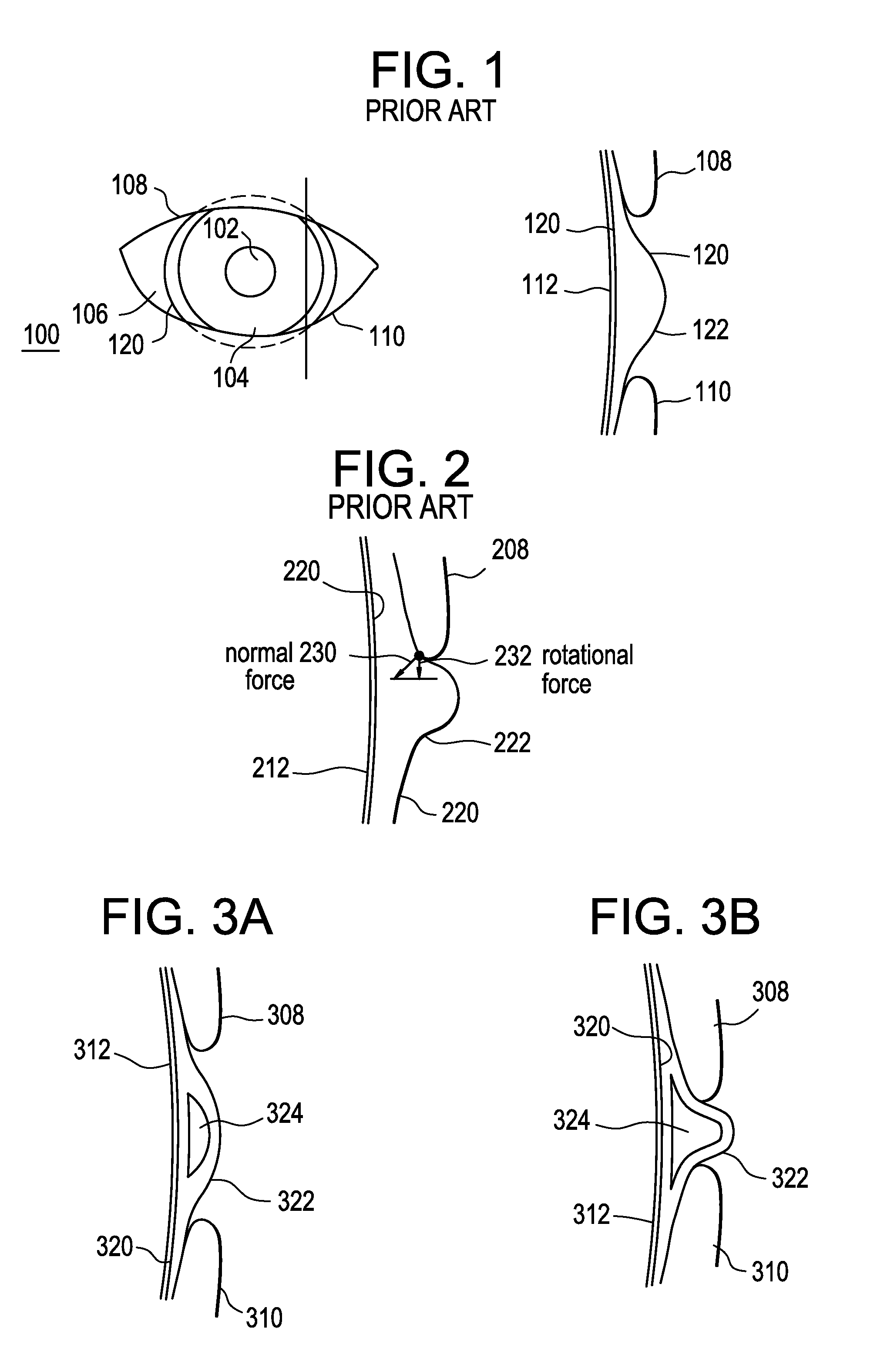 Dynamic fluid zones in contact lenses