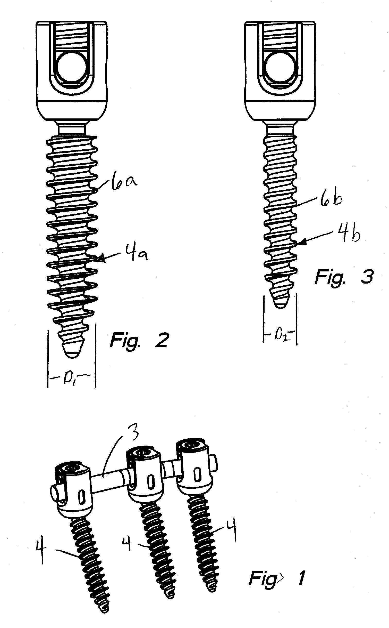 Polyaxial bone screw