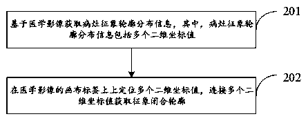 Lesion volume measurement method and device