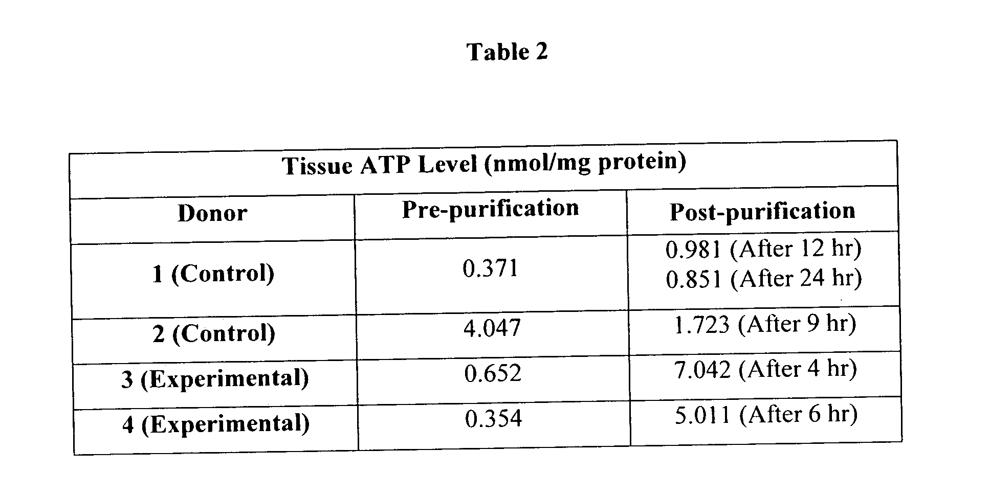 Methods of islet isolation and transplantation