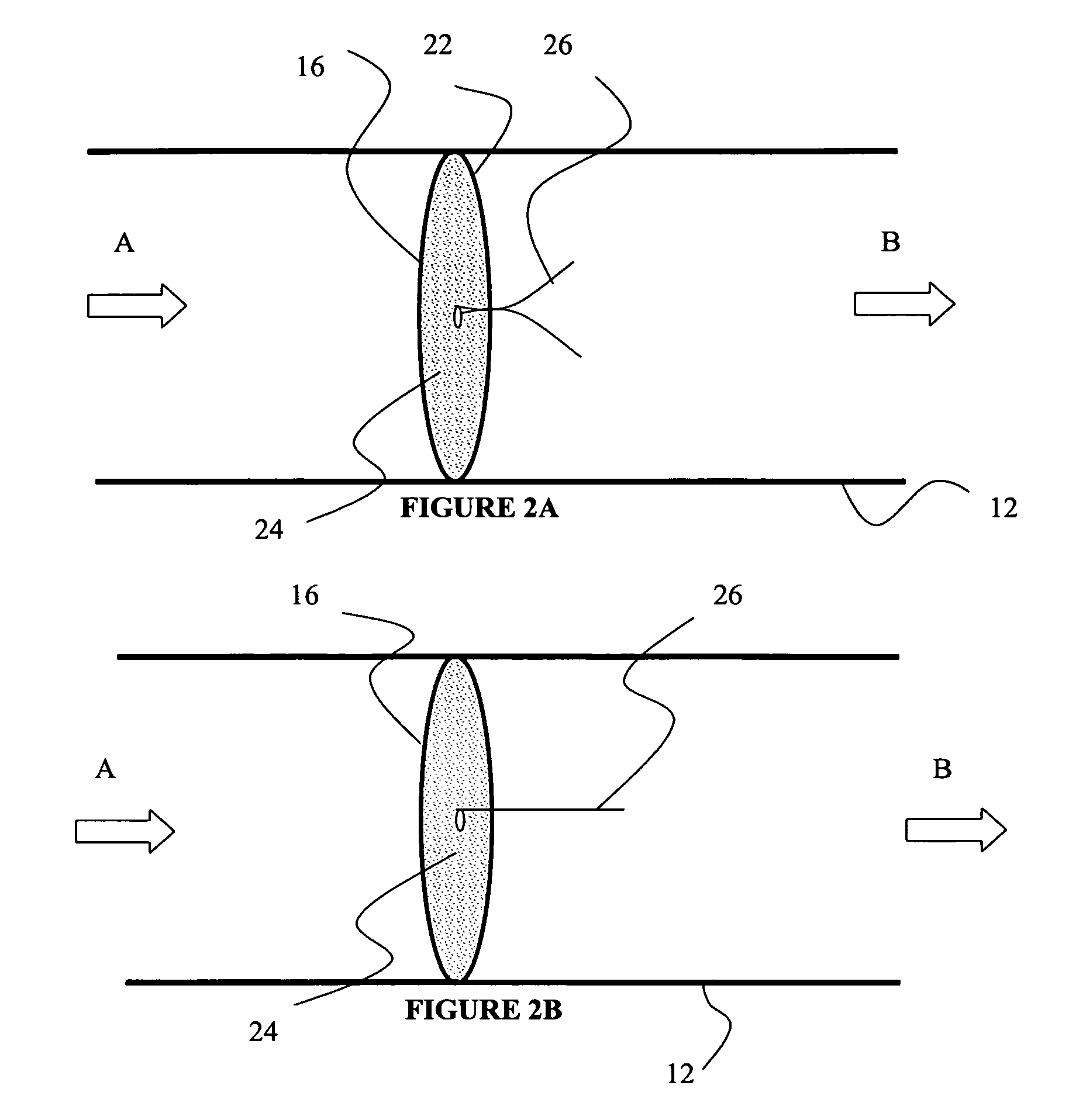 Implantable prosthetic device for connection to a fluid flow pathway of a patient