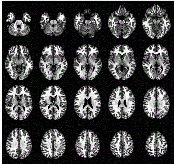 A method for fMRI identification of camouflaged cognitive dysfunction