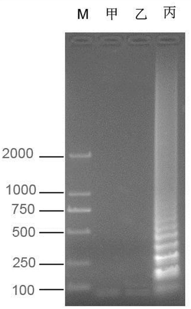 A set of primers for detection of influenza C virus lamp and its application