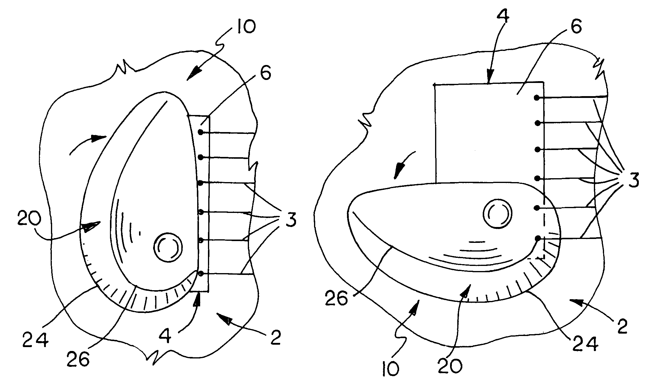 Tremolo attachment for a stringed instrument