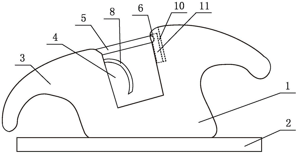 An orthodontic self-ligating bracket that can effectively express torque