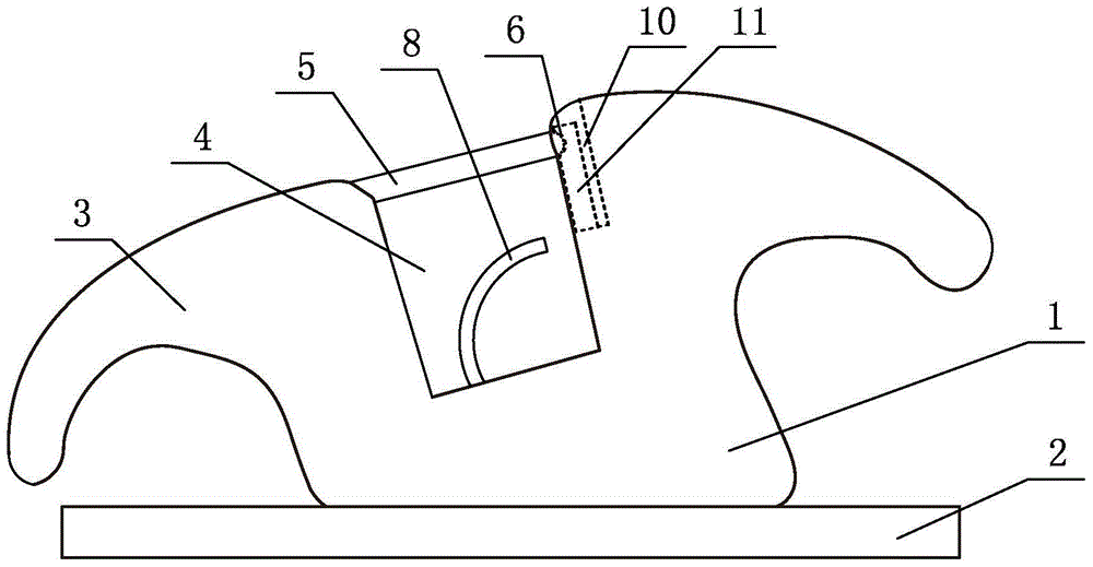 An orthodontic self-ligating bracket that can effectively express torque