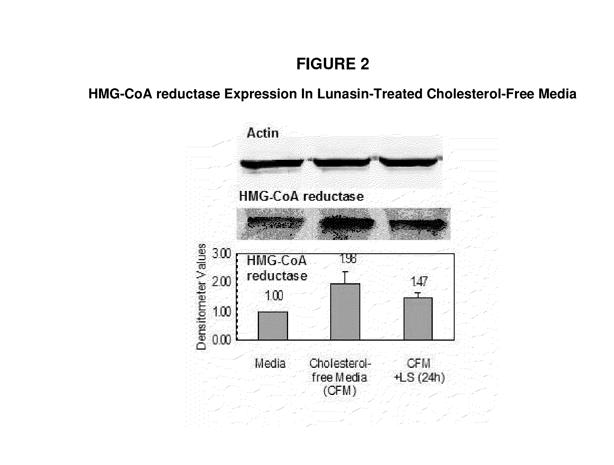 Products and methods using soy peptides to lower total and ldl cholesterol levels