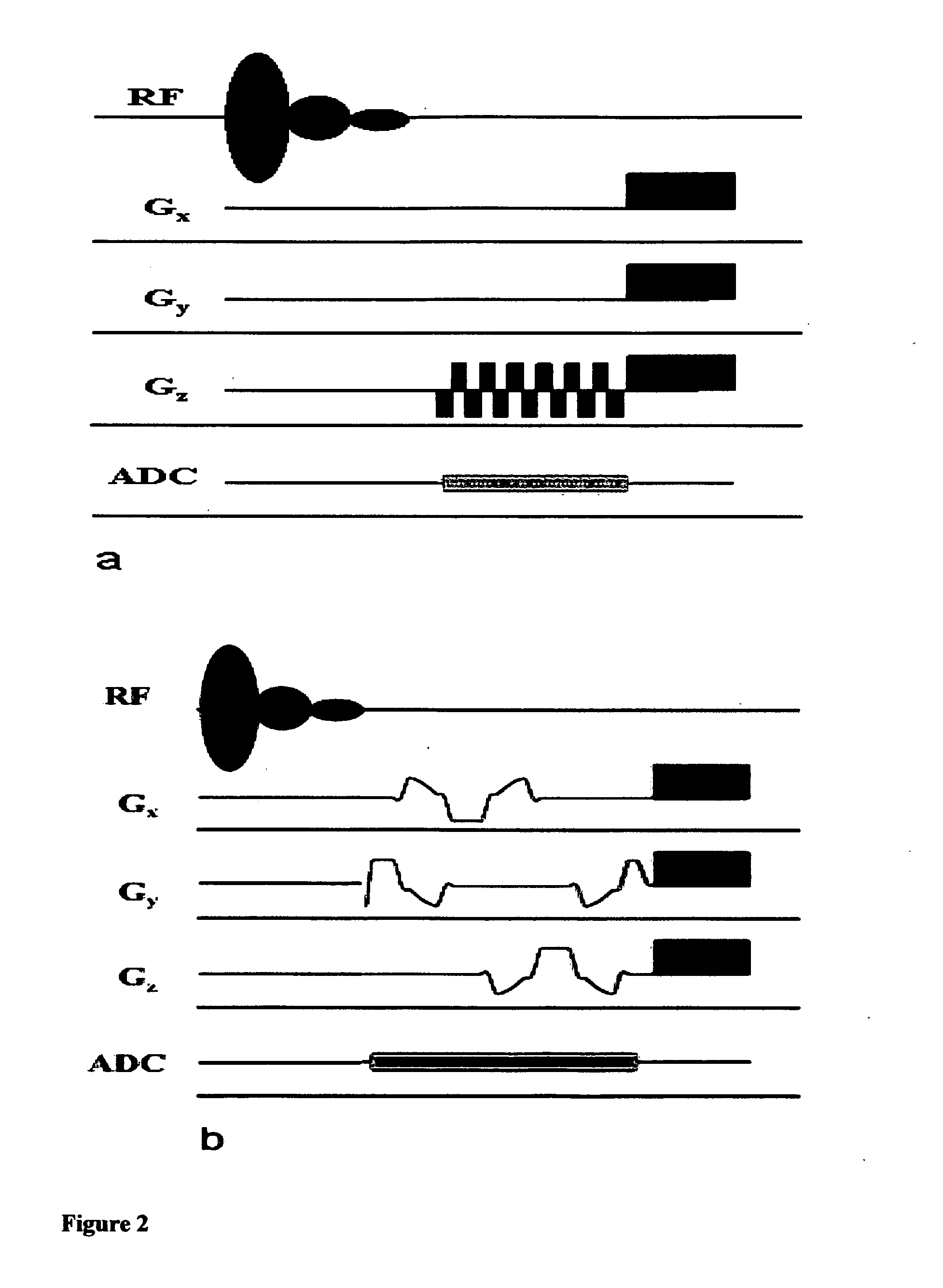 Magnetic resonance spectroscopy with real-time correction of motion and frequency drift, and real-time shimming