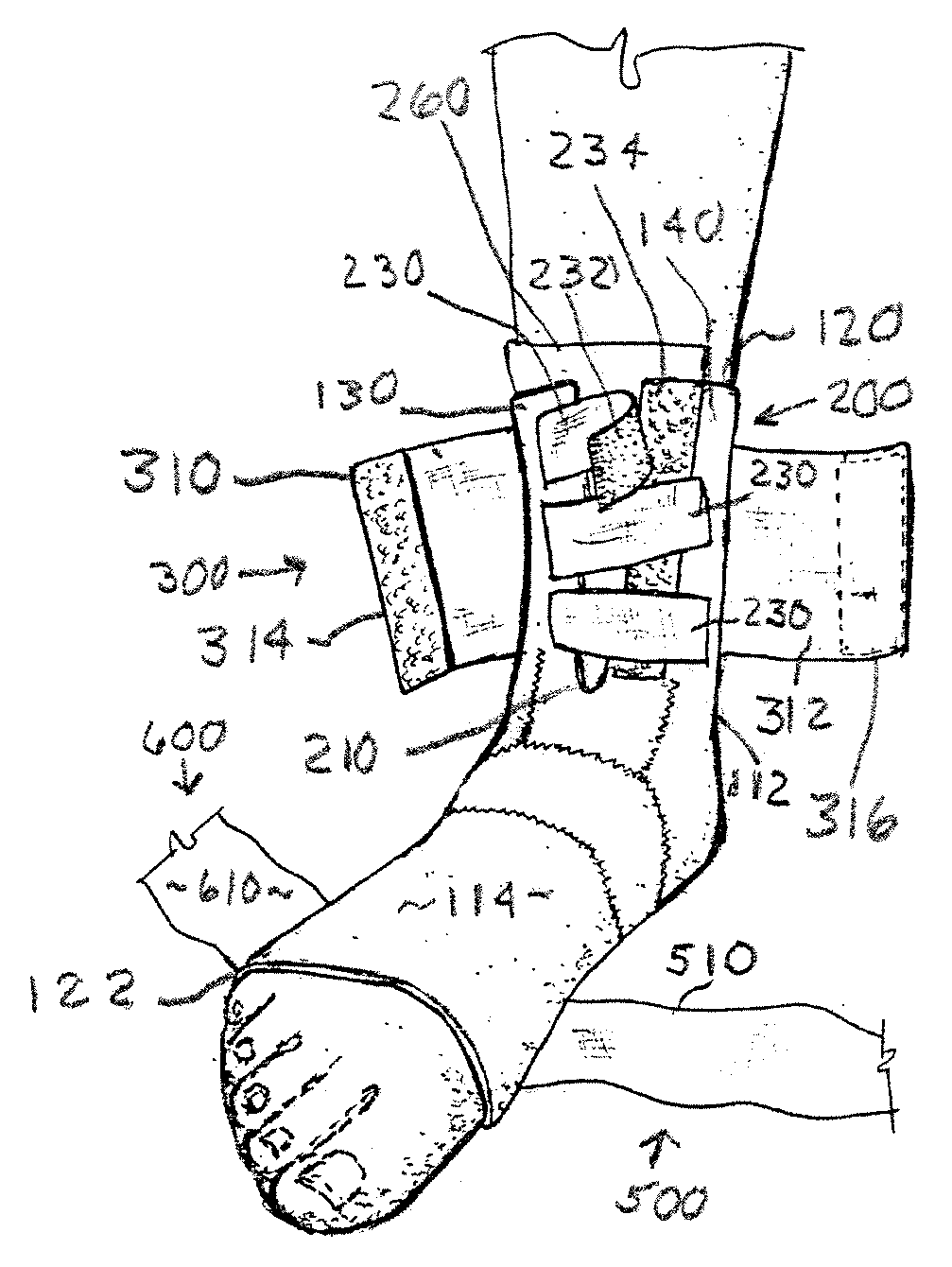 Counterforce brace