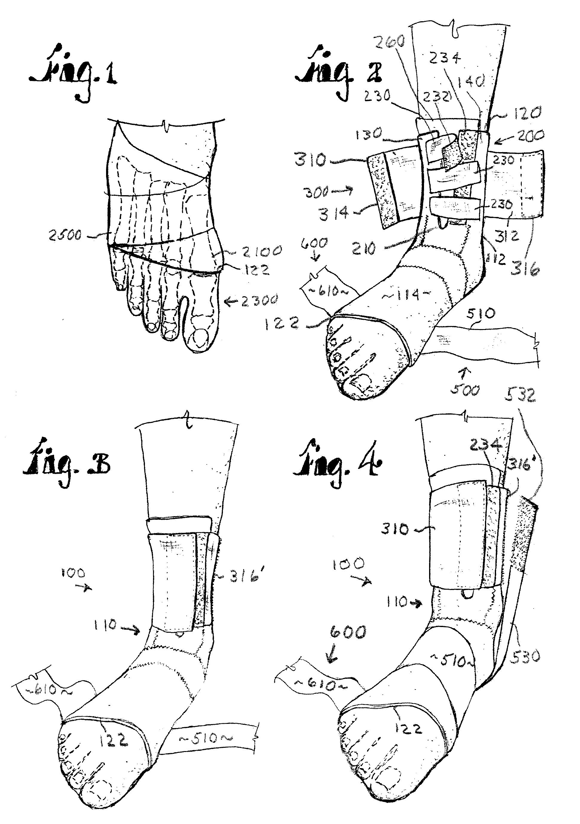 Counterforce brace