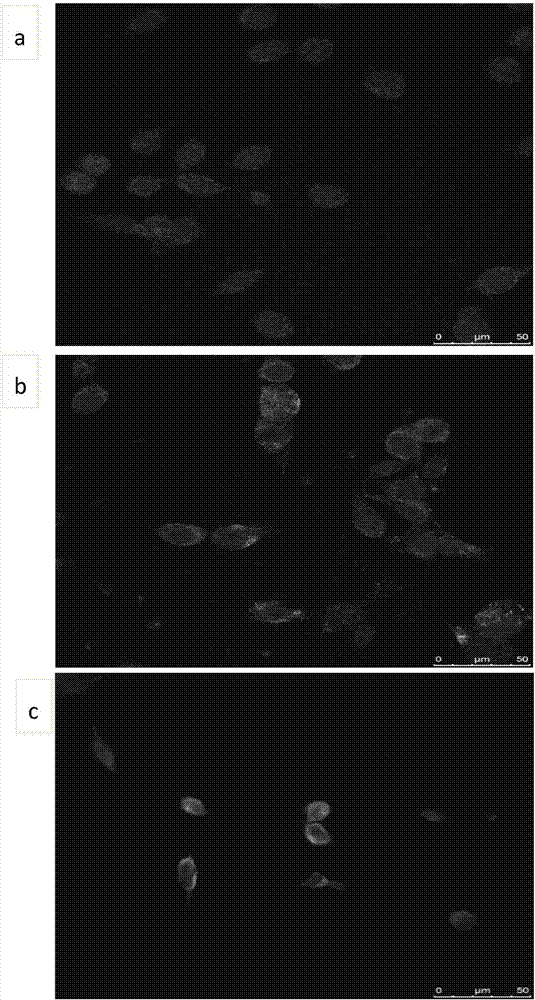 Preparation method and use of TCR gene modified CD8+T memory stem cell