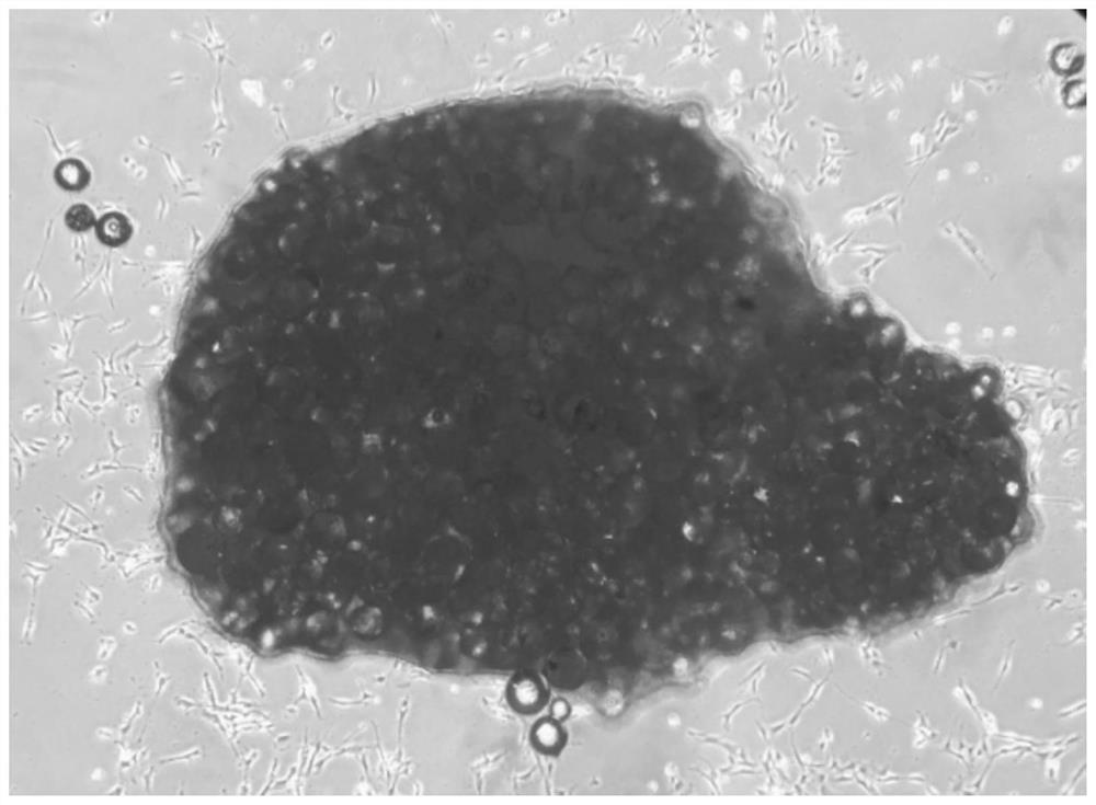 Isolation and culture method of dental pulp mesenchymal stem cells