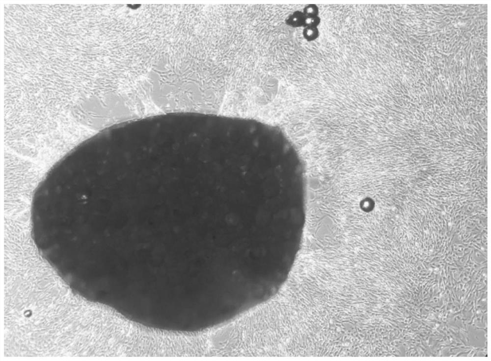 Isolation and culture method of dental pulp mesenchymal stem cells