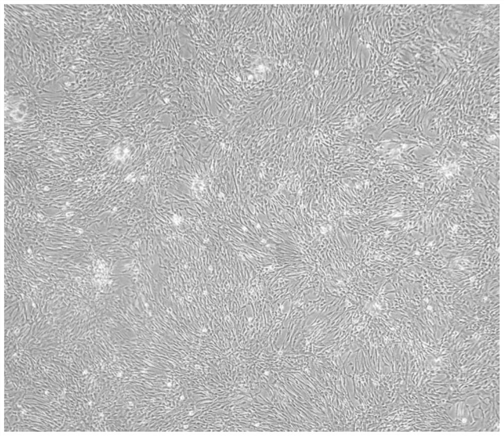 Isolation and culture method of dental pulp mesenchymal stem cells