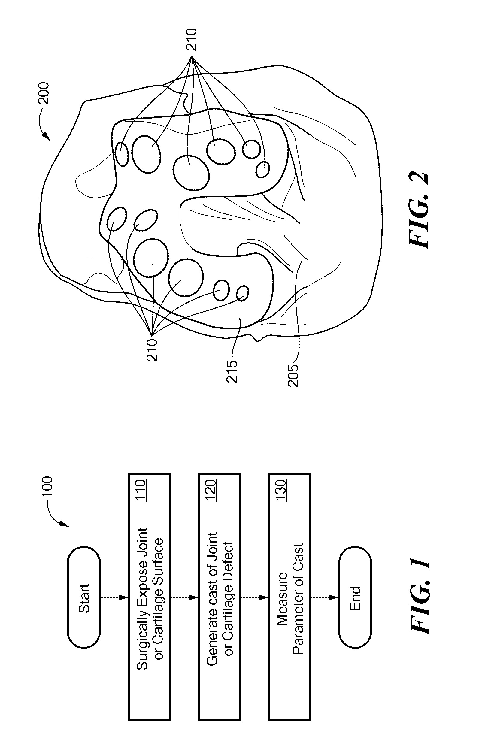 Methods and Devices For Quantitative Analysis of Bone and Cartilage Defects